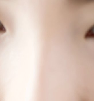 Banish Blackheads For Good Article