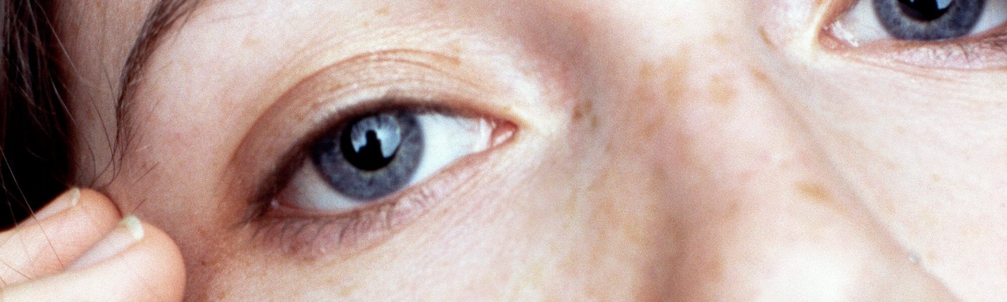 How To Choose The Right Concealer To Banish Dark Circles Hero