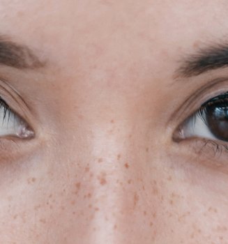 Oxygen A Breath Of Fresh Air For Perfect Skin Article