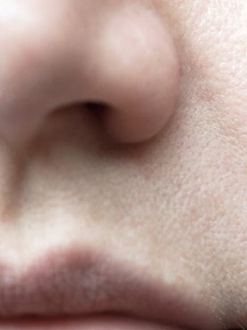 The 5 Beauty Benefits Of Glycolic Acid Article