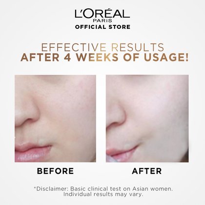White Perfect Laser Essence 1