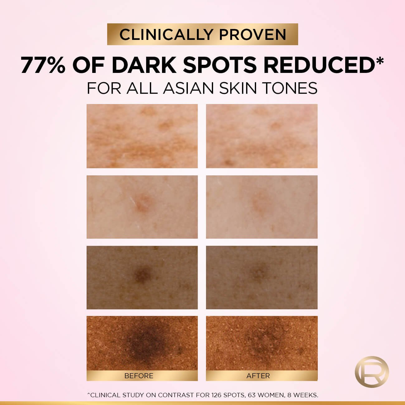 L Oréal Paris Glycolic Bright 8 Melasyl Glycolic Niacinamide