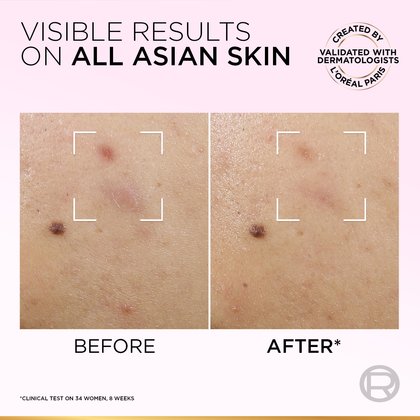 Exfoliant Peeling 5